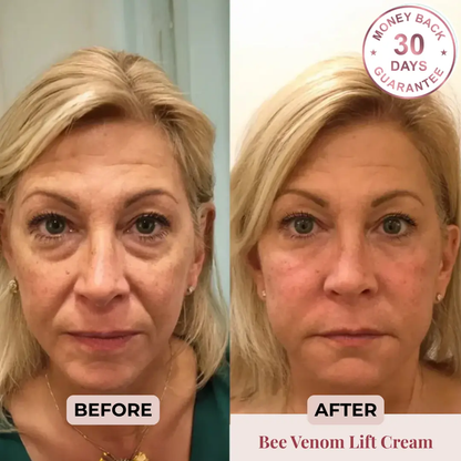 Bee Venom Lifting+ Cream Shape Muse