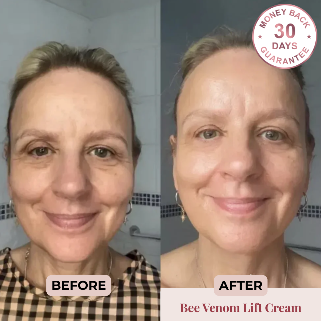 Bee Venom Lifting+ Cream Shape Muse