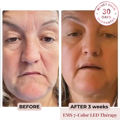 EMS 7-Color LED Facial Massager